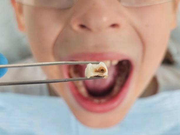 Best 24-Hour Emergency Dental Care in Mcmillin, WA