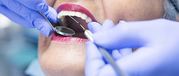 Best Emergency Cosmetic Dentistry (e.g., broken veneers) in Mcmillin, WA